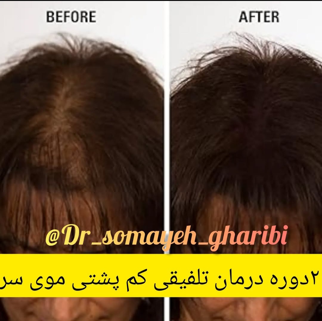 اضافه شده توسط  فرزانه