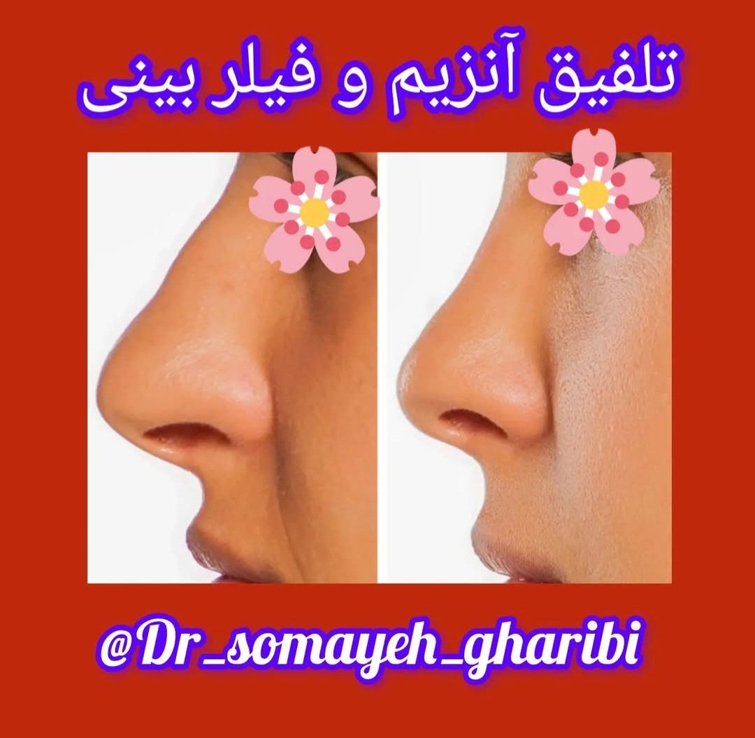 اضافه شده توسط  فرزانه