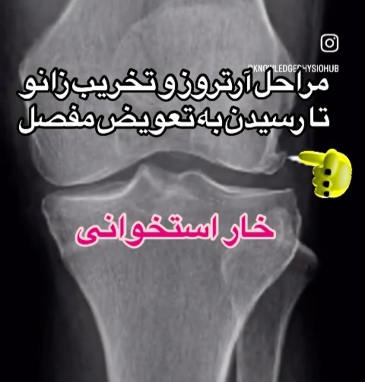 اضافه شده توسط <br> فاطمه