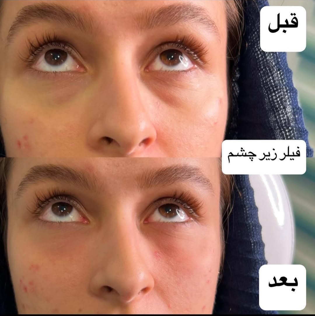 اضافه شده توسط  فرزانه