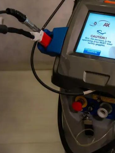 لیزر موتوس زیربغل