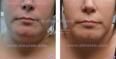 مرکز تخصصی پوست و لیزر سیما طب