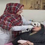 بوتاکس لیفت بینی