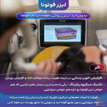 فوتونا میکرودرلینگ سر با مزو فیوژن