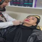 بوتاکس زاویه فک